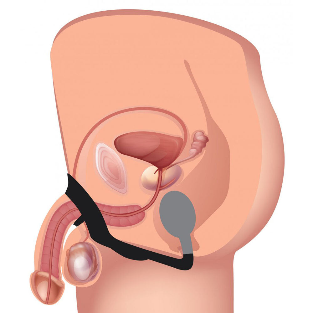 Prostate Massager With Remote & Cock Ring - Alpha-Pro P-Bomb