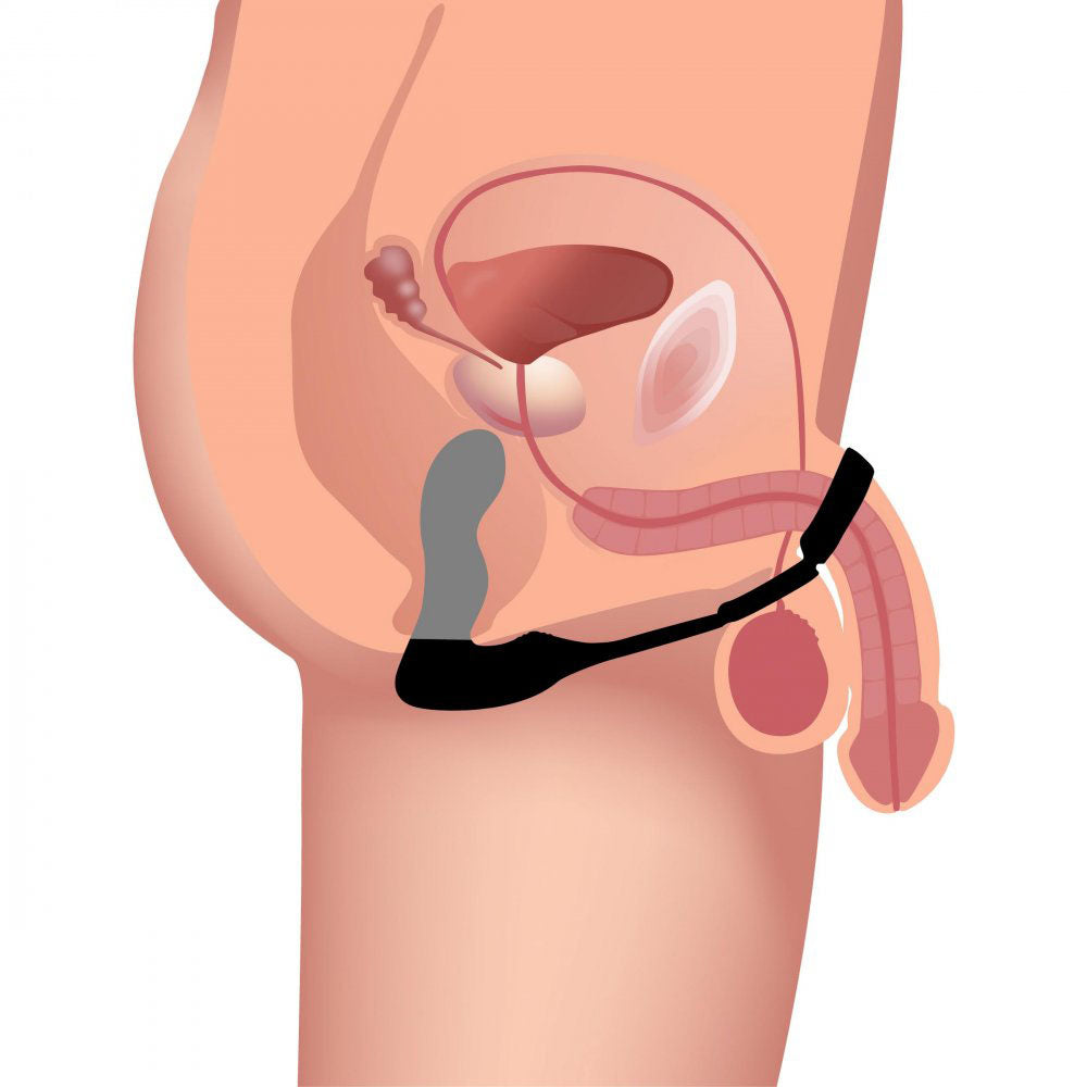 Inflatable Prostate Massager With Remote & Cock Ring - Swell